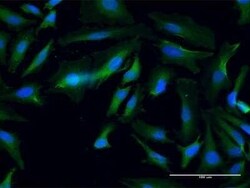 ANKMY1 Antibody, Novus Biologicals 0.05 mg | Buy Online | Novus Biologicals | Fisher Scientific
