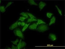 ANKRA2 Antibody (1D11), Novus Biologicals 0.1 mg | Buy Online | Novus Biologicals | Fisher Scientific