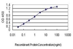 ANKRA2 Antibody (1D11), Novus Biologicals 0.1 mg | Buy Online | Novus Biologicals | Fisher Scientific