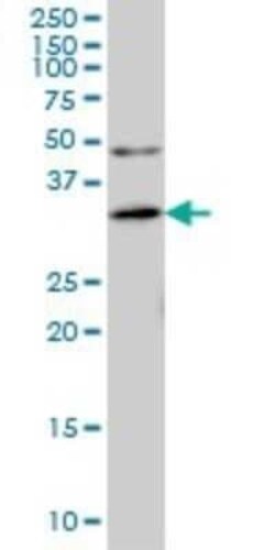 ANKRA2 Antibody (1D11), Novus Biologicals 0.1 mg | Buy Online | Novus Biologicals | Fisher Scientific
