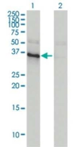 ANKRA2 Antibody (1D11), Novus Biologicals 0.1 mg | Buy Online | Novus Biologicals | Fisher Scientific