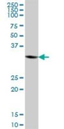 ANKRD1 Antibody, Novus Biologicals 0.05 mg | Buy Online | Novus Biologicals | Fisher Scientific
