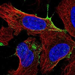 ANKRD13B Antibody, Novus Biologicals:Antibodies:Primary Antibodies