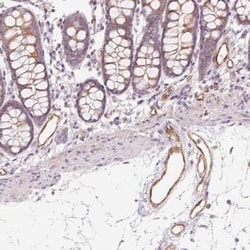 ANKRD13B Antibody, Novus Biologicals:Antibodies:Primary Antibodies