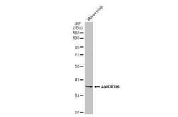 ANKRD16 Antibody, Novus Biologicals 100 &mu;g | Buy Online | Novus Biologicals | Fisher Scientific