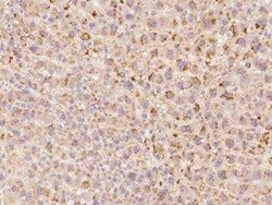 ANKRD22 Antibody, Novus Biologicals 100 &mu;g; Unconjugated:Antibodies,