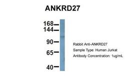 ANKRD27 Antibody, Novus Biologicals 100 &mu;L | Buy Online | Novus Biologicals | Fisher Scientific