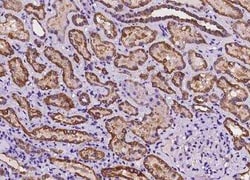 ANKRD30B Antibody, Novus Biologicals 100 &mu;g; Unconjugated:Anticuerpos