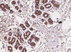 ANKRD30B Antibody, Novus Biologicals 100 &mu;g; Unconjugated:Anticuerpos