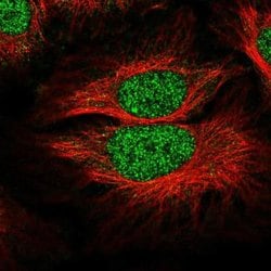ANKRD32 Antibody, Novus Biologicals:Antibodies:Primary Antibodies