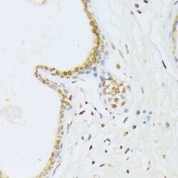 ANKRD52 Antibody - BSA Free, Novus Biologicals 0.02 mL, Unconjugated:Antibodies,