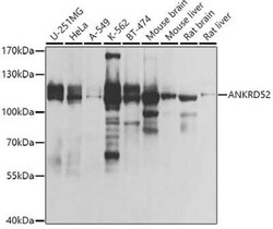 ANKRD52 Antibody - BSA Free, Novus Biologicals 0.02 mL, Unconjugated:Antibodies,