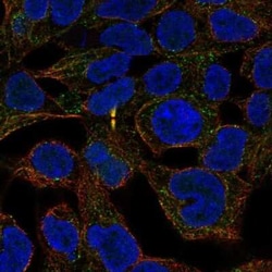 ANKRD54 Antibody, Novus Biologicals 25 &mu;L, Unconjugated:Antibodies,