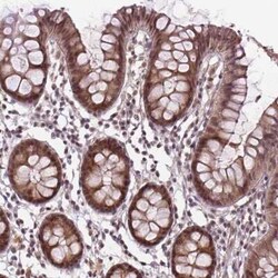ANKRD54 Antibody, Novus Biologicals 25 &mu;L, Unconjugated:Antibodies,