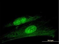 ANKRD7 Antibody, Novus Biologicals 0.05 mg | Buy Online | Novus Biologicals | Fisher Scientific