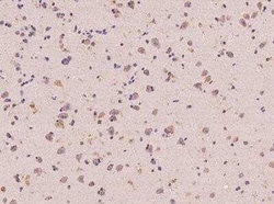 ANKS6 Antibody, Novus Biologicals 100 &mu;g; Unconjugated:Anticuerpos