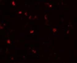 ANO2 Antibody - BSA Free, Novus Biologicals 0.1 mg; Unconjugated:Antibodies,