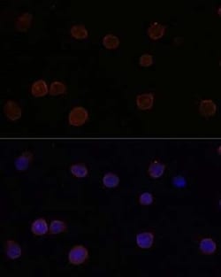 ANO2 Antibody - Azide and BSA Free, Novus Biologicals 0.1 mL, Unconjugated:Antibodies,