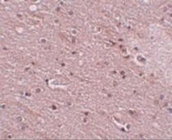 ANO2 Antibody - BSA Free, Novus Biologicals 0.1 mg; Unconjugated:Antibodies,