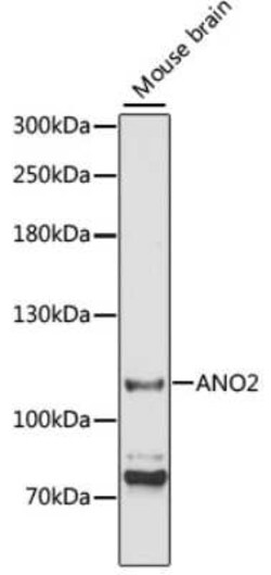 ANO2 Antibody - Azide and BSA Free, Novus Biologicals 0.1 mL, Unconjugated:Antibodies,