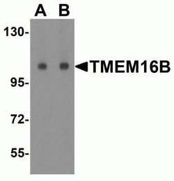 ANO2 Antibody - BSA Free, Novus Biologicals 0.1 mg; Unconjugated:Antibodies,