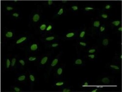 ANP32B Antibody (8E10), Novus Biologicals 0.1 mg | Buy Online | Novus Biologicals | Fisher Scientific
