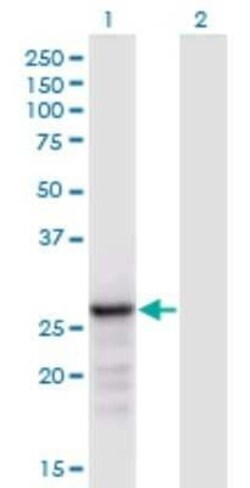 ANP32B Antibody (8E10), Novus Biologicals 0.1 mg | Buy Online | Novus Biologicals | Fisher Scientific