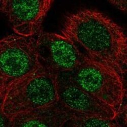 ANP32B Rabbit anti-Human, Polyclonal, Novus Biologicals:Antibodies:Primary