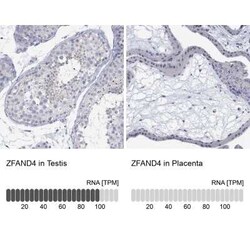 ANUBL1 Rabbit anti-Human, Polyclonal, Novus Biologicals 100 &mu;g; Unconjugated:Antibodies,