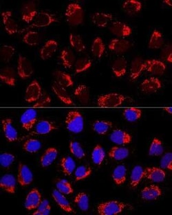 AP1M2 Antibody - BSA Free, Novus Biologicals:Antibodies:Primary Antibodies