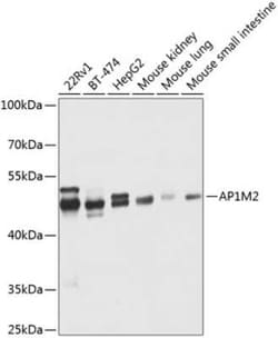 AP1M2 Antibody - BSA Free, Novus Biologicals:Antibodies:Primary Antibodies