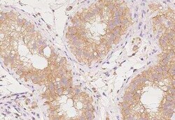 AP2A2 Antibody, Novus Biologicals:Antibodies:Primary Antibodies