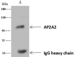 AP2A2 Antibody, Novus Biologicals:Antibodies:Primary Antibodies