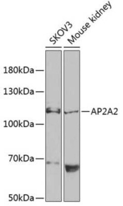 AP2A2 Antibody - BSA Free, Novus Biologicals 0.1 mL, Unconjugated:Antibodies,