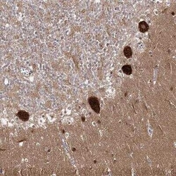 AP2M1 Antibody, Novus Biologicals 25 &mu;L; Unconjugated:Antibodies, Polyclonal