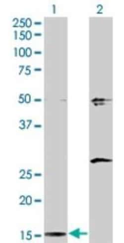 AP2S1 Antibody (3E4), Novus Biologicals 0.1 mg | Buy Online | Novus Biologicals | Fisher Scientific