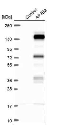 AP3B2 Antibody, Novus Biologicals 25 &mu;L; Unconjugated:Antibodies, Polyclonal