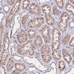 AP3M1 Antibody, Novus Biologicals 25 &mu;L, Unconjugated:Antibodies, Polyclonal