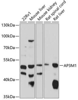 AP3M1 Antibody - BSA Free, Novus Biologicals 0.02 mL, Unconjugated:Antibodies,
