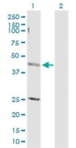 AP4M1 Antibody, Novus Biologicals 0.1 mg | Buy Online | Novus Biologicals | Fisher Scientific