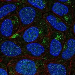 AP5B1 Antibody, Novus Biologicals:Antibodies:Primary Antibodies