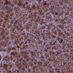 AP5B1 Antibody, Novus Biologicals:Antibodies:Primary Antibodies