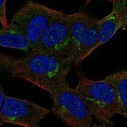 APBA2 Rabbit anti-Human, Polyclonal, Novus Biologicals 25 &mu;g; Unconjugated:Antibodies,