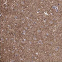 APC Antibody, Novus Biologicals 0.1 mL | Buy Online | Novus Biologicals | Fisher Scientific
