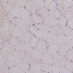 APC Antibody, Novus Biologicals 0.1 mL | Buy Online | Novus Biologicals | Fisher Scientific