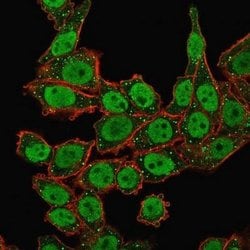 APE Mouse anti-Human, Clone: CPTC-APEX1-2, Novus Biologicals 20 &mu;g;