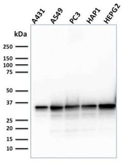 APE Mouse anti-Human, Clone: CPTC-APEX1-2, Novus Biologicals 20 &mu;g;