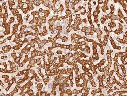 APMAP Antibody, Novus Biologicals:Anticorps:Anticorps primaires