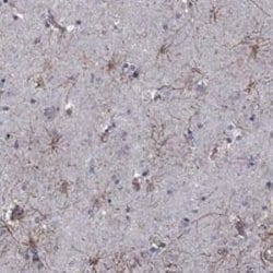 APPBP2 Rabbit anti-Human, Polyclonal, Novus Biologicals 25 &mu;g; Unconjugated:Antibodies,