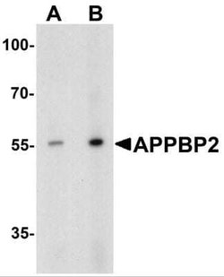 APPBP2 Antibody - BSA Free, Novus Biologicals 0.1 mg | Buy Online | Novus Biologicals | Fisher Scientific